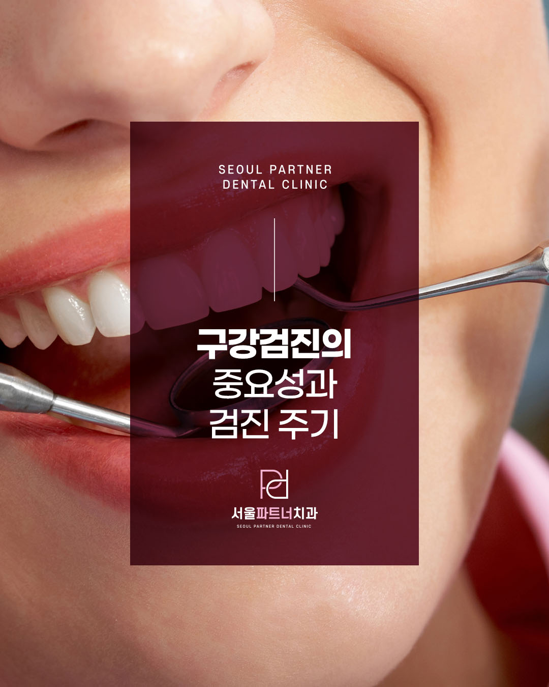 #구강검진의 #중요성과 #검진주기